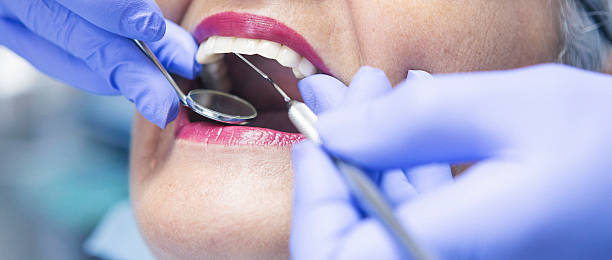 Best Emergency Treatment for Toothache in Statesboro, GA